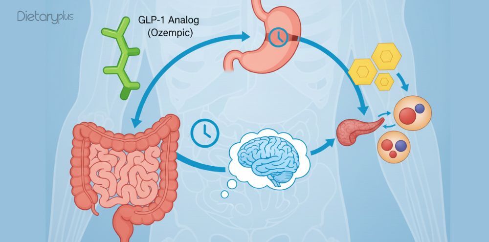 Ozempic y paralisis estomacal